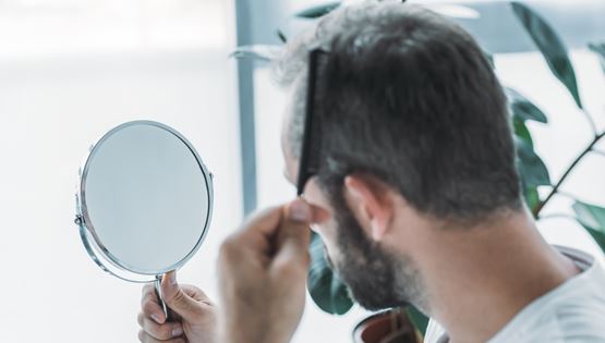 Όλη η αλήθεια για τη μεταμόσχευση μαλλιών