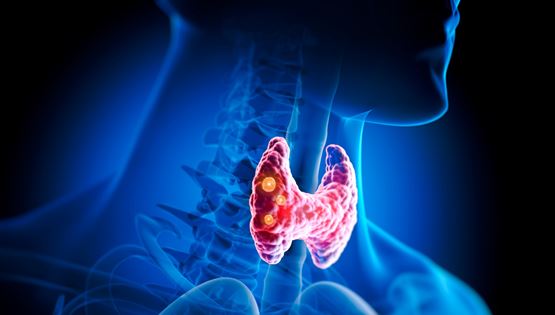 Αφαίρεση Θυρεοειδούς (Θυρεοειδεκτομή): Θα αλλάξει η ζωή μου μετά την επέμβαση; Τι πρέπει να περιμένω;