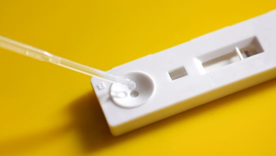 Νέο διαγνωστικό τεστ ανιχνεύει τον SARS-CoV-2 σε μόλις 5&#39;