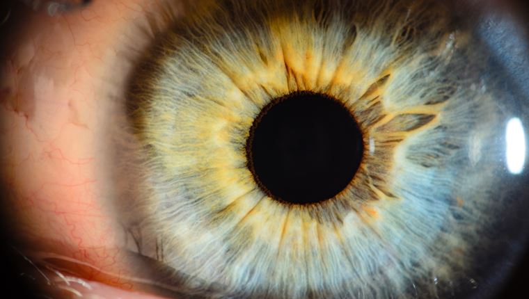 Κι όμως, υπάρχει ένα χρώμα ματιών που έχει μόνο το 1% του πληθυσμού