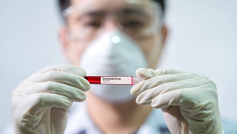 Ο ΠΟΥ διερευνά την προέλευση της COVID-19