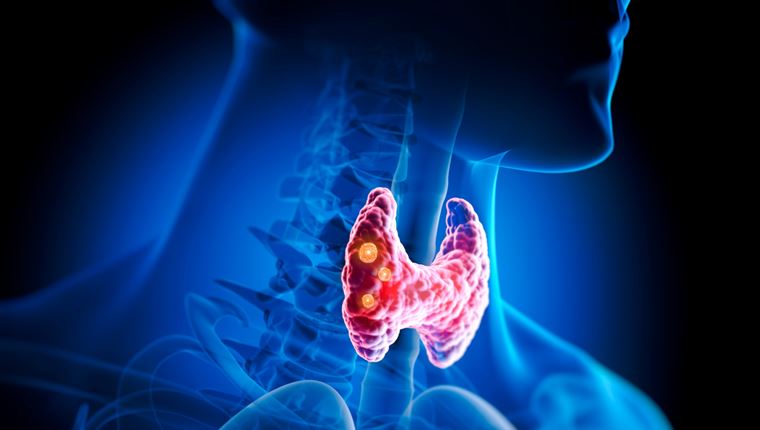 Αφαίρεση Θυρεοειδούς (Θυρεοειδεκτομή): Θα αλλάξει η ζωή μου μετά την επέμβαση; Τι πρέπει να περιμένω;