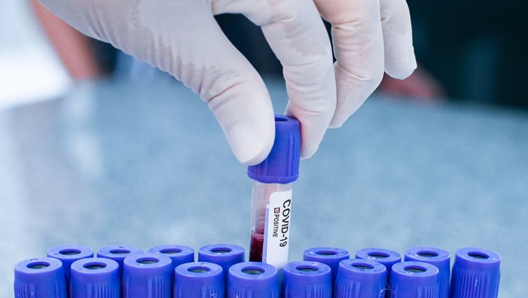 Το ποσοστό των πραγματικά ασυμπτωματικών με κορονοϊό σύμφωνα με νέα έρευνα