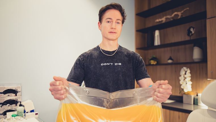 Mεγιστάνας αφαίρεσε &#39;όλο το πλάσμα από το σώμα του&#39; για να δείχνει νεότερος