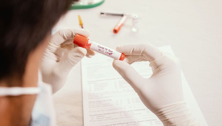 Το επιδημιολογικό προφίλ του κορονοϊού στην Ελλάδα