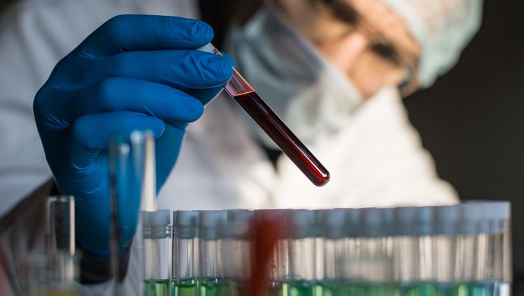 Η ομάδα αίματος που είναι η πιο ευάλωτη στον κορονοϊό