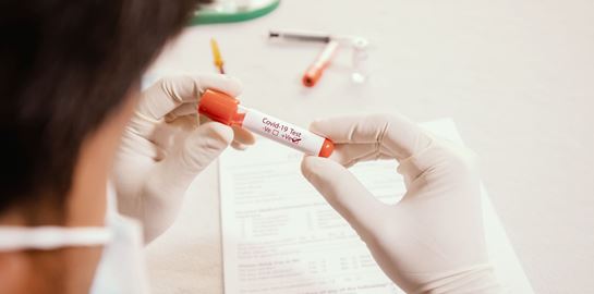 Το επιδημιολογικό προφίλ του κορονοϊού στην Ελλάδα